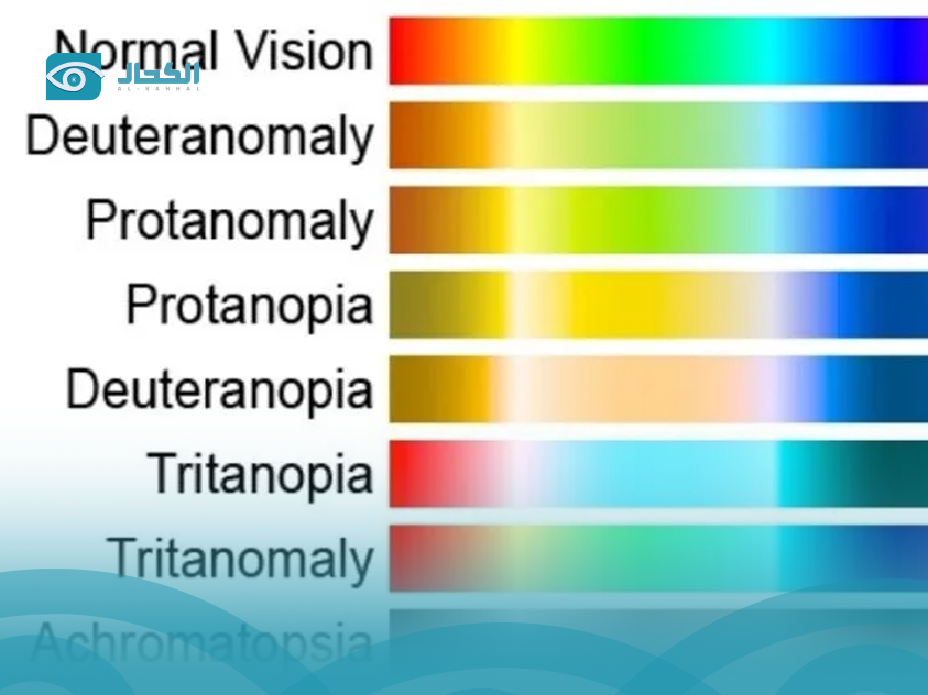 types-of-color-blindness