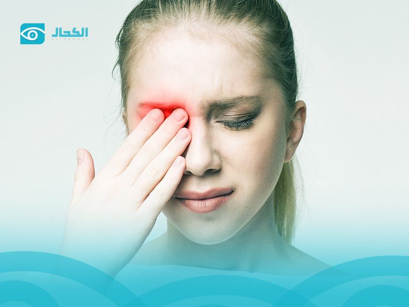 التهاب-غشاء-العين