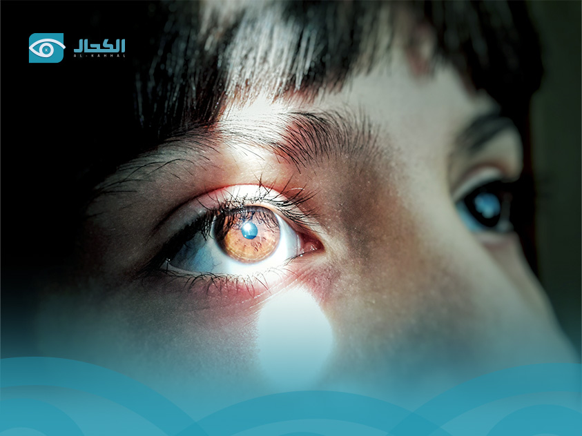  ازدواج-الرؤية