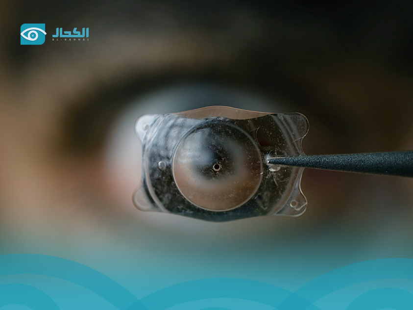 سعر-عدسات-النظر