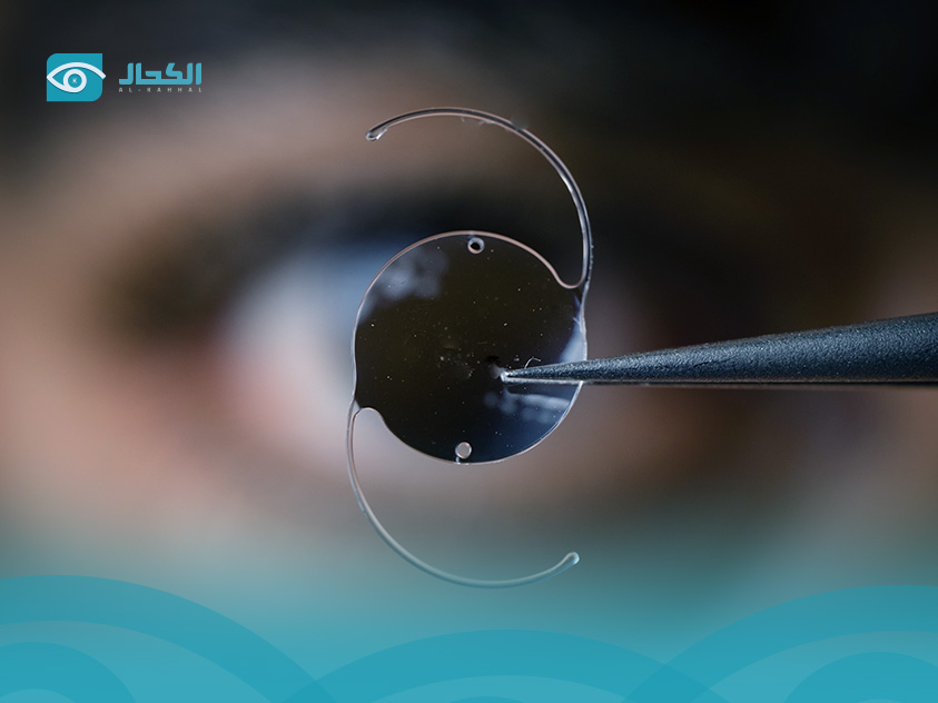 سعر-فحص-النظر
