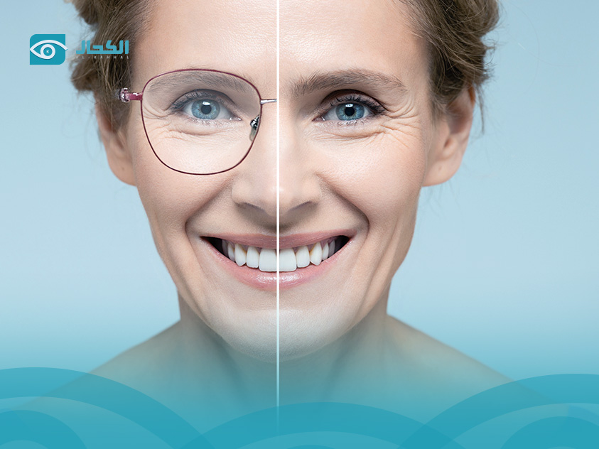 شروط إجراء جراحة الليزك