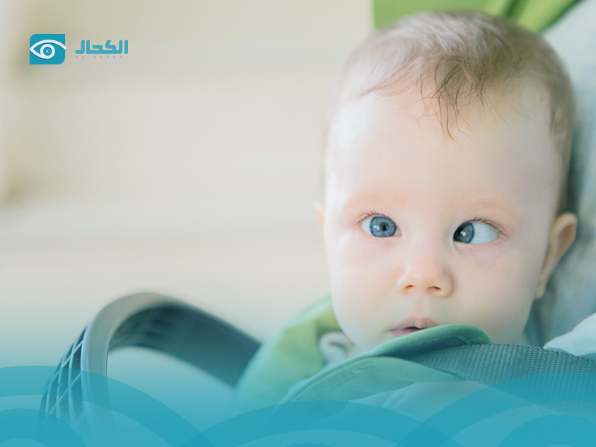 علاج-انحراف-النظر