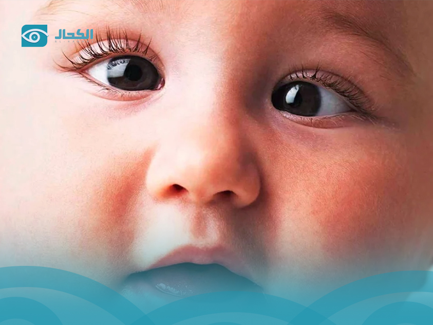 الحول-الوحشي