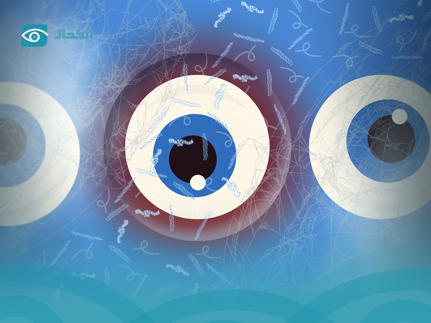 ذبابة-العين علاج الذبابة الطائرة في العين