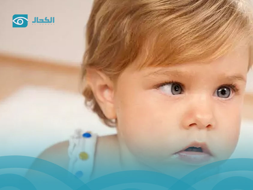 رأرأة-العين رأرأة-العين