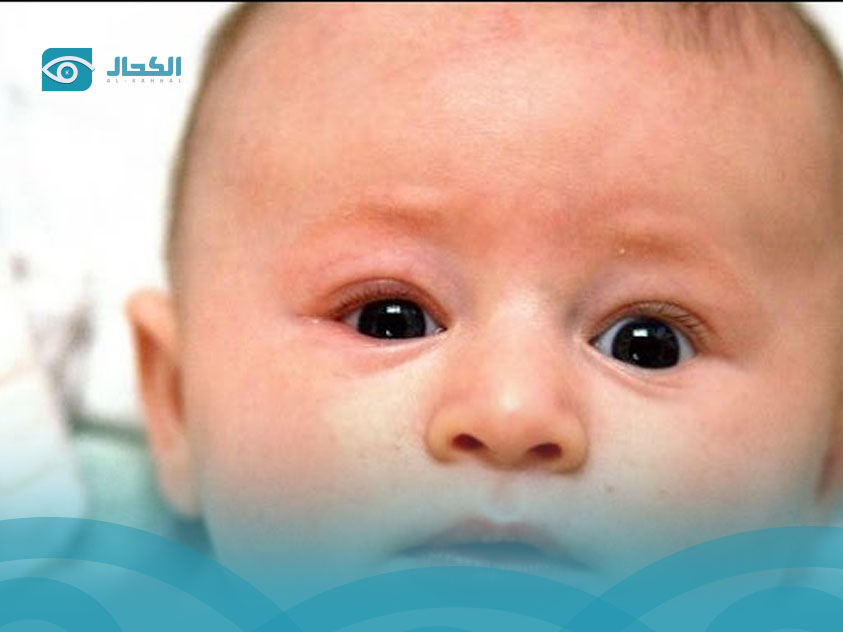 رأرأة-العين رأرأة-العين