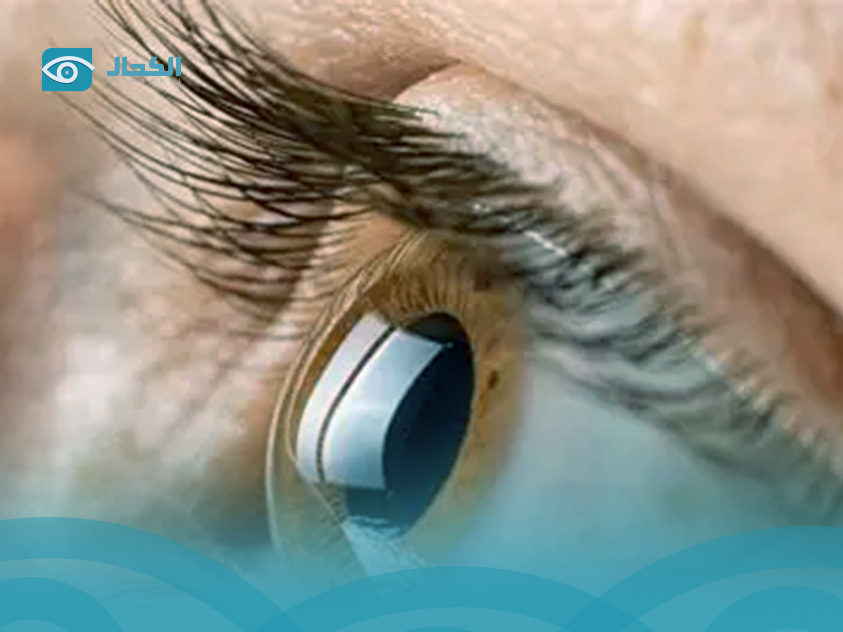 العلاج الجديد فابيسمو