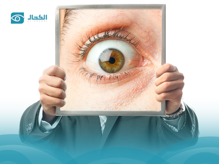 أمراض-العيون-بالصور